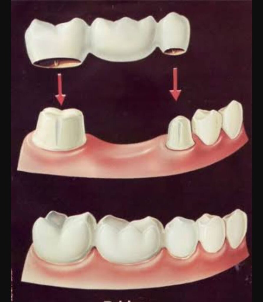 da2d9438-b5cb-4607-b4be-703c925246c8 Da2d9438 B5cb 4607 B4be 703c925246c8 893x1024