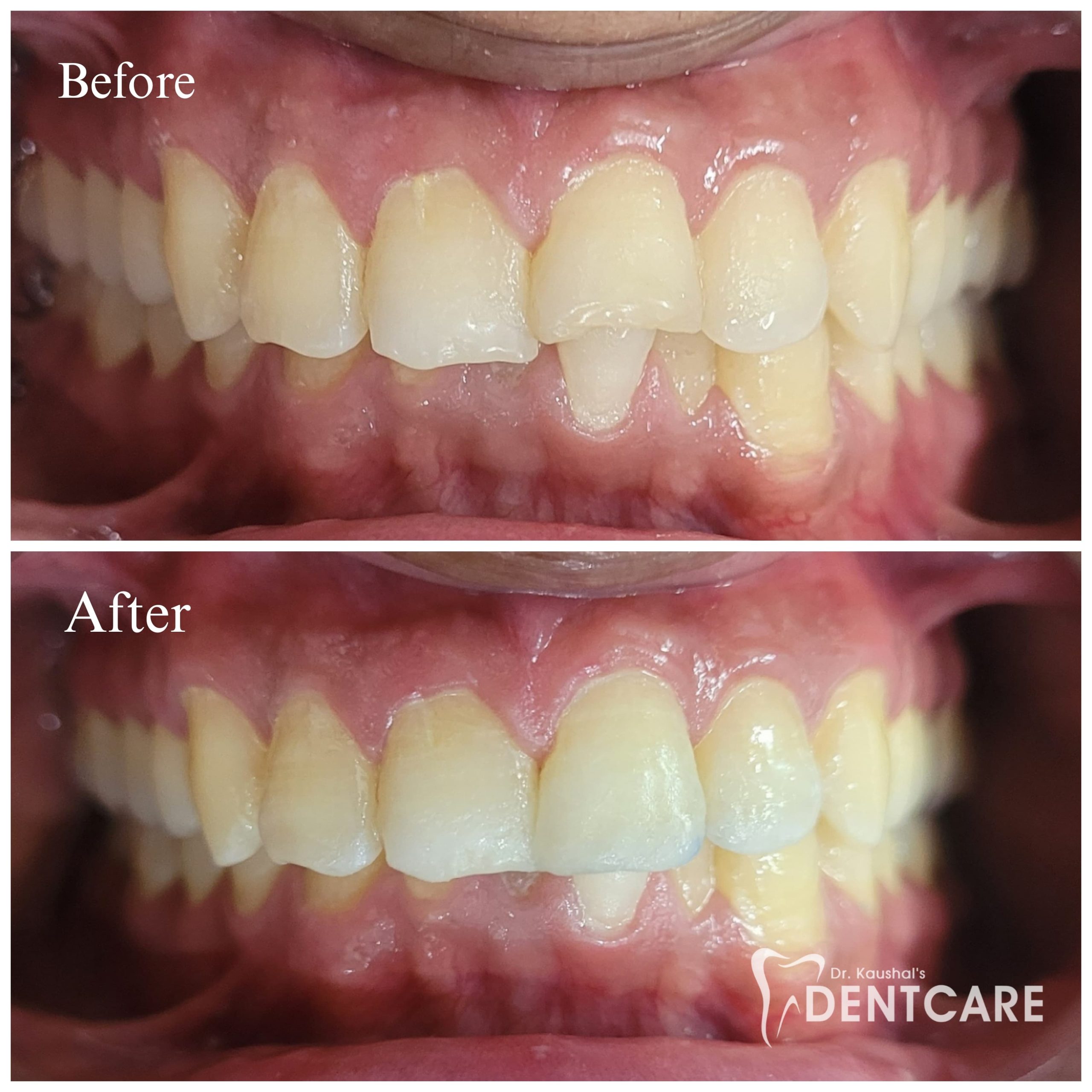 impact-img img-20250731-wa0011