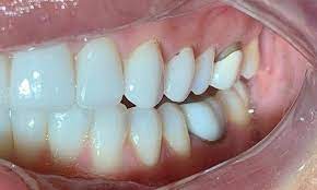 images (2) images (2)